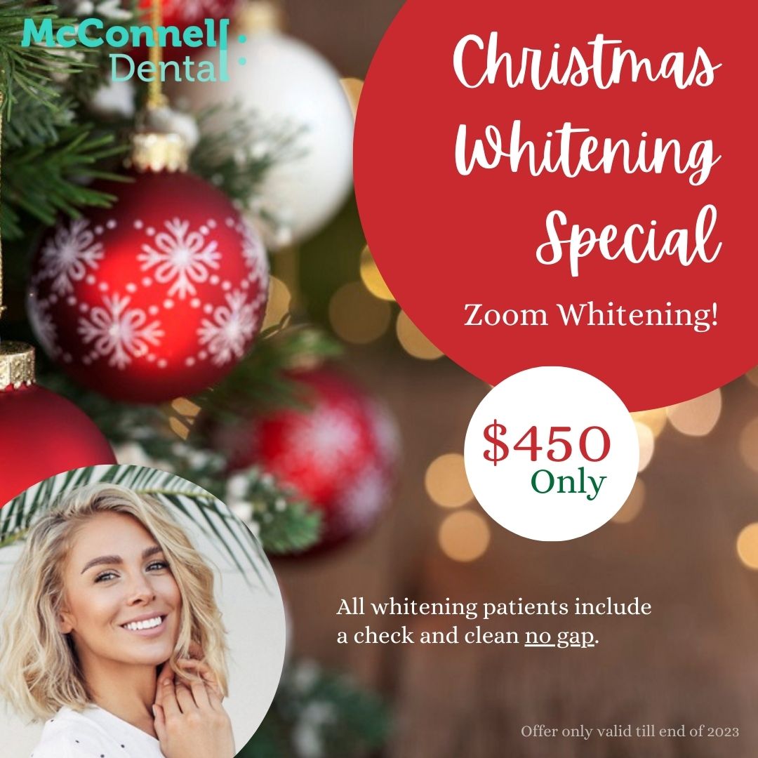 Special Offers | McConnell Dental